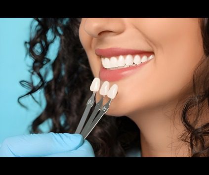 durable dental veneers in jagatpura jaipur