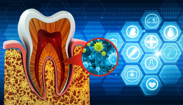 gum disease treatment in jagatpura jaipur